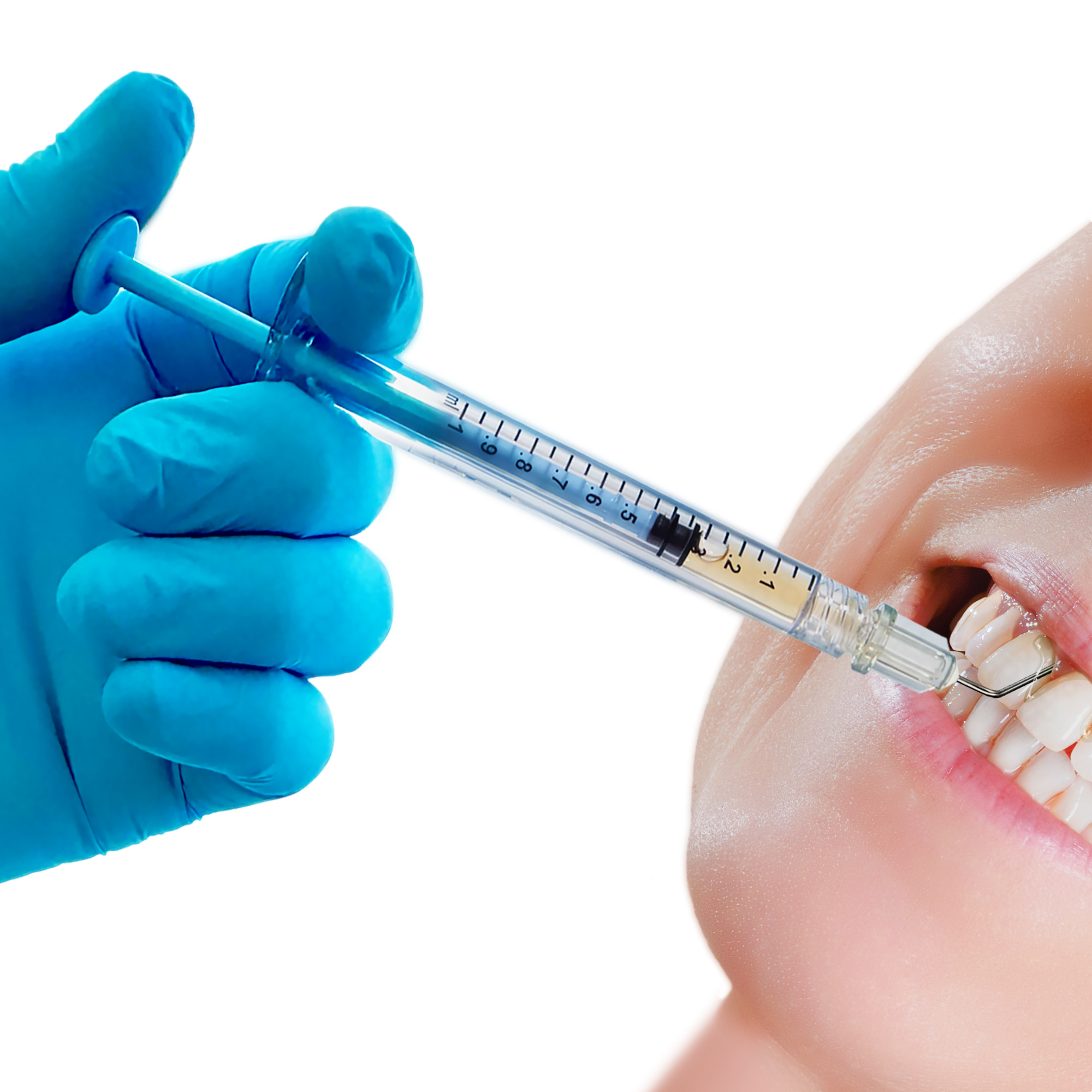 AKTION: 2 x Sterify Gel 0,3 ml Spritze + 1 x PCP11.5B6 Parodontometer WHO #11.5B Gr #6 Qulix